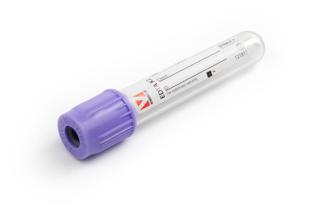 KRUUSE Blutentnahmeröhrchen EDTA K2, 2ml, 100 Stk KRUUSE Blutentnahmeröhrchen EDTA K2, 2ml, 100 Stk