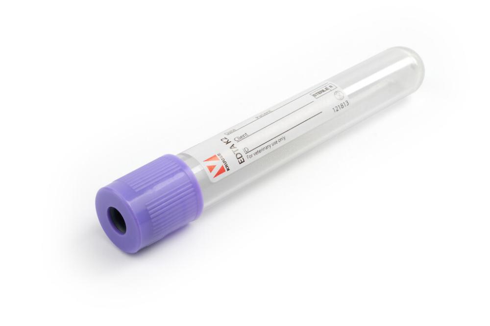 KRUUSE Blutentnahmeröhrchen EDTA K2, 10ml, 100 Stk KRUUSE Blutentnahmeröhrchen EDTA K2, 10ml, 100 Stk